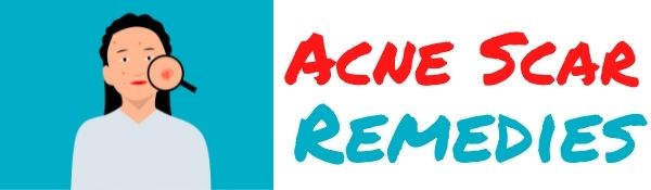 Acne Scar Remedies Logo